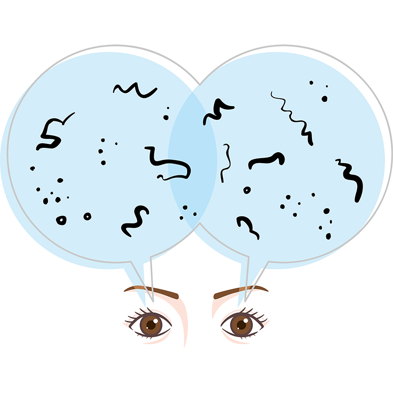 飛蚊症・網膜剥離